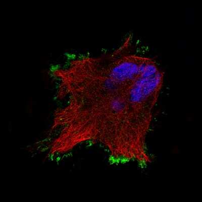 Immunocytochemistry/ Immunofluorescence: Ezrin Antibody (CL2375) [NBP2-36759]