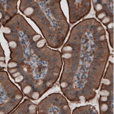 Immunohistochemistry: Ezrin Antibody (CL2375) [NBP2-36759]
