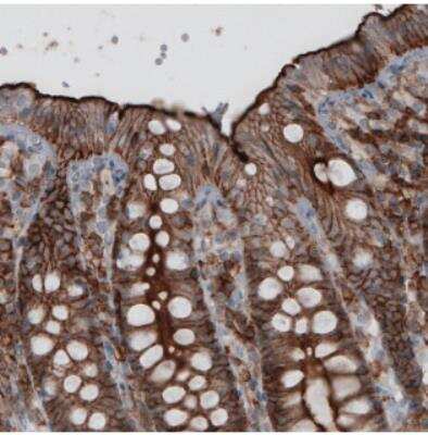 Immunohistochemistry: Ezrin Antibody (CL2375) [NBP2-36759]