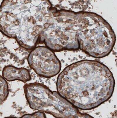 Immunohistochemistry: Ezrin Antibody (CL2375) [NBP2-36759]