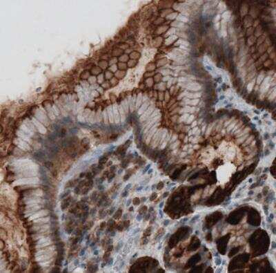 Immunohistochemistry: Ezrin Antibody (CL2375) [NBP2-36759]