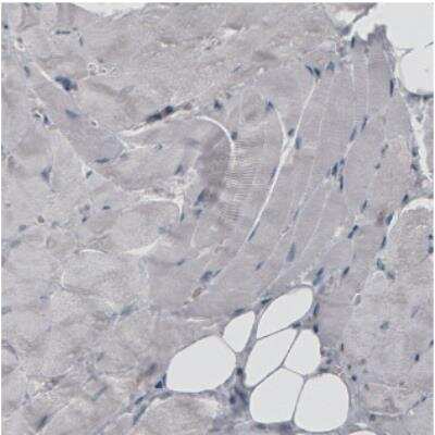 Immunohistochemistry: Ezrin Antibody (CL2375) [NBP2-36759]