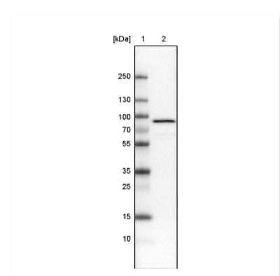 Western Blot: Ezrin Antibody (CL2375) [NBP2-36759]