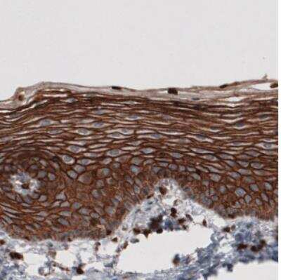 Immunohistochemistry: Ezrin Antibody (CL2378) [NBP2-36762]