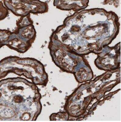Immunohistochemistry: Ezrin Antibody (CL2378) [NBP2-36762]