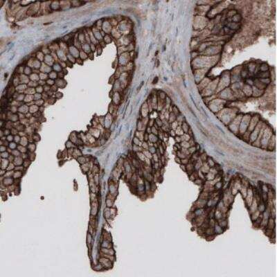 Immunohistochemistry: Ezrin Antibody (CL2378) [NBP2-36762]
