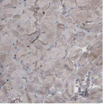 Immunohistochemistry: Ezrin Antibody (CL2378) [NBP2-36762]