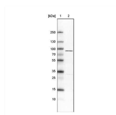 Western Blot: Ezrin Antibody (CL2378) [NBP2-36762]