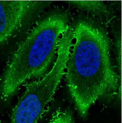 Immunocytochemistry/ Immunofluorescence: Ezrin Antibody (CL2384) [NBP2-36760]
