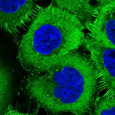 Immunocytochemistry/ Immunofluorescence: Ezrin Antibody (CL2384) [NBP2-36760]