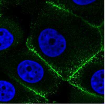 Immunocytochemistry/ Immunofluorescence: Ezrin Antibody (CL2384) [NBP2-36760]