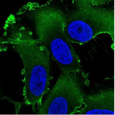Immunocytochemistry/ Immunofluorescence: Ezrin Antibody (CL2384) [NBP2-36760]