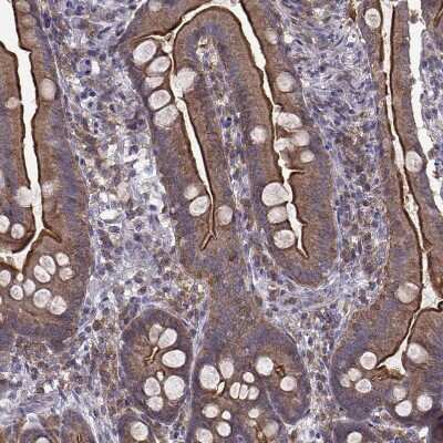 Immunohistochemistry-Paraffin: Ezrin Antibody (CL2384) [NBP2-36760]