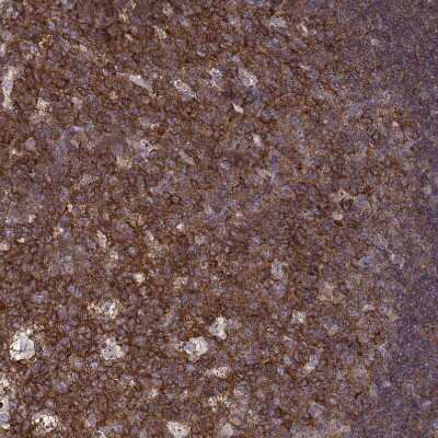 Immunohistochemistry-Paraffin: Ezrin Antibody (CL2384) [NBP2-36760]