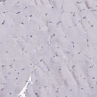 Immunohistochemistry-Paraffin: Ezrin Antibody (CL2384) [NBP2-36760]