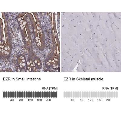 Immunohistochemistry-Paraffin: Ezrin Antibody (CL2384) [NBP2-36760]