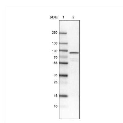 Western Blot: Ezrin Antibody (CL2384) [NBP2-36760]