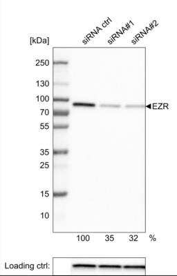 Western Blot: Ezrin Antibody (CL2384) [NBP2-36760]