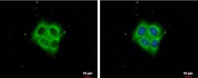 Immunocytochemistry/ Immunofluorescence: Ezrin Antibody [NBP2-16396]