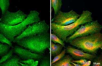 Immunocytochemistry/ Immunofluorescence: Ezrin Antibody [NBP2-16396]