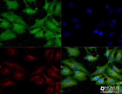 Immunocytochemistry/ Immunofluorescence: Ezrin Antibody - BSA Free [NBP2-52977]