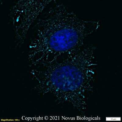 Immunocytochemistry/ Immunofluorescence: Ezrin Antibody - BSA Free [NBP2-52977]