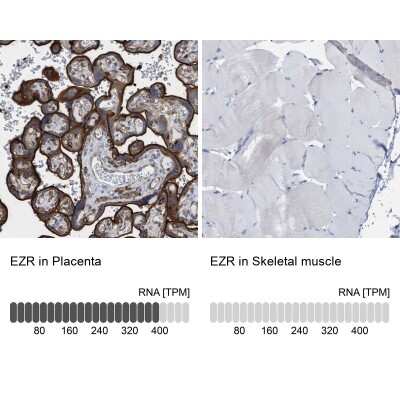 Immunohistochemistry-Paraffin: Ezrin Antibody [NBP1-86863]