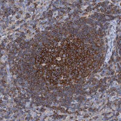 Immunohistochemistry-Paraffin: Ezrin Antibody [NBP1-86863]
