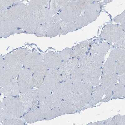 Immunohistochemistry-Paraffin: Ezrin Antibody [NBP1-86863]