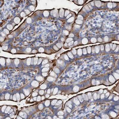 Immunohistochemistry-Paraffin: Ezrin Antibody [NBP1-86863]