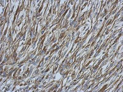 Immunohistochemistry-Paraffin: Ezrin Antibody [NBP2-16396]