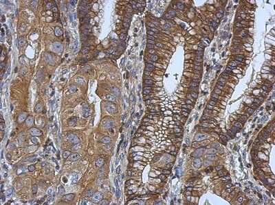 Immunohistochemistry-Paraffin: Ezrin Antibody [NBP2-16396]