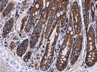 Immunohistochemistry-Paraffin: Ezrin Antibody [NBP2-16396]