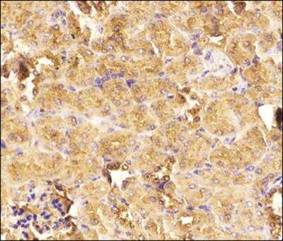 Immunohistochemistry-Paraffin: Ezrin Antibody - BSA Free [NBP2-52977]
