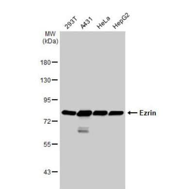 Western Blot: Ezrin Antibody [NBP2-16396]