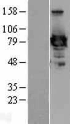 Western Blot: Ezrin Overexpression Lysate [NBL1-10401]