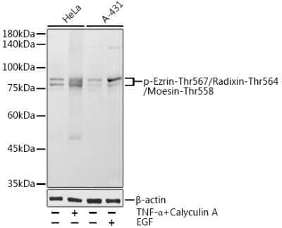 Western Blot: Ezrin/Radixin/Moesin [p Thr567, p Thr564, p Thr558] AntibodyAzide and BSA Free [NBP3-16959]