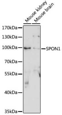 Western Blot: F-Spondin/SPON1 AntibodyAzide and BSA Free [NBP3-03648]