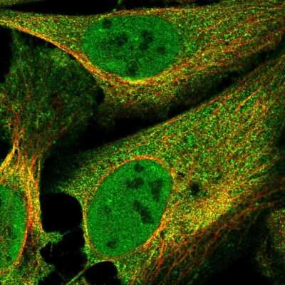 Immunocytochemistry/ Immunofluorescence: F box protein 38 Antibody [NBP2-58958]