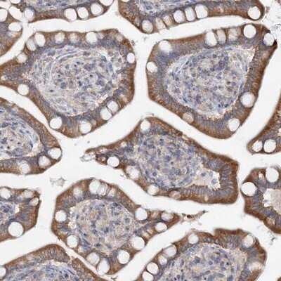 Immunohistochemistry-Paraffin: F box protein 38 Antibody [NBP1-87932]