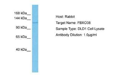 Western Blot: F box protein 38 Antibody [NBP2-87387]