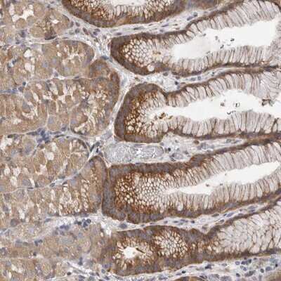 Immunohistochemistry-Paraffin: F-box protein 43 Antibody [NBP1-84708]