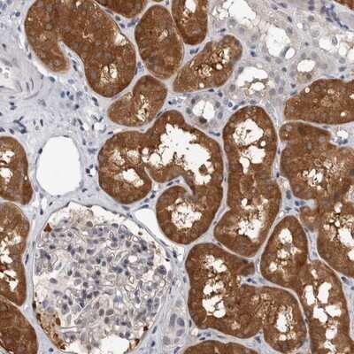 Immunohistochemistry-Paraffin: F-box protein 43 Antibody [NBP1-84709]