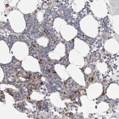 Immunohistochemistry-Paraffin: F-box protein 43 Antibody [NBP1-84710]