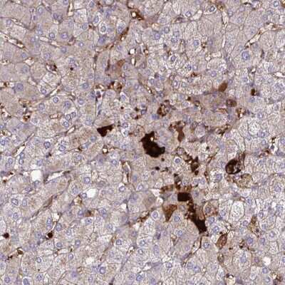 Immunohistochemistry-Paraffin: Coagulation Factor II/Thrombin Antibody [NBP2-33617]
