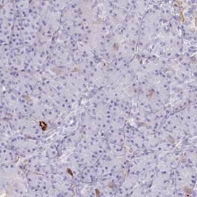 Immunohistochemistry-Paraffin: Coagulation Factor II/Thrombin Antibody [NBP2-33617]
