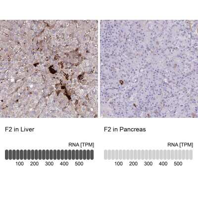 Immunohistochemistry-Paraffin: Coagulation Factor II/Thrombin Antibody [NBP2-33617]