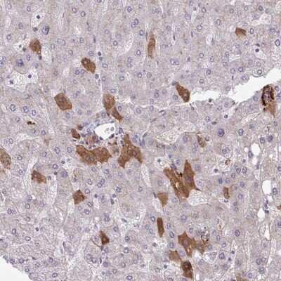 Immunohistochemistry-Paraffin: Coagulation Factor II/Thrombin Antibody [NBP2-33728]