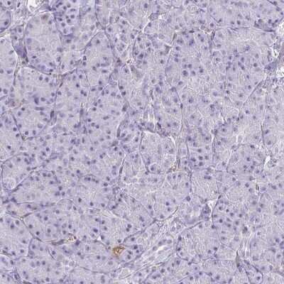 Immunohistochemistry-Paraffin: Coagulation Factor II/Thrombin Antibody [NBP2-33728]