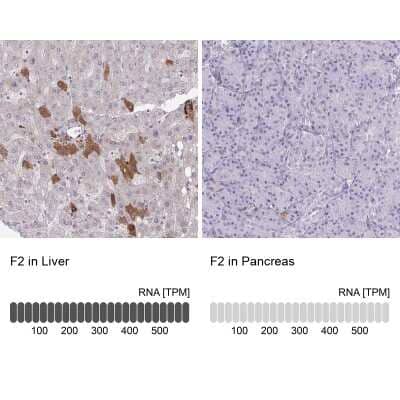 Immunohistochemistry-Paraffin: Coagulation Factor II/Thrombin Antibody [NBP2-33728]